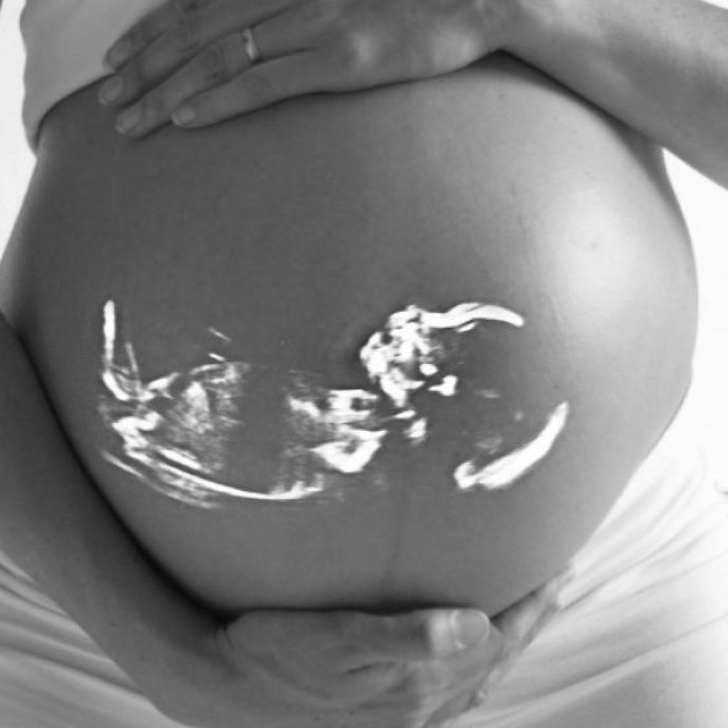 Mengenal Pemeriksaan NIPT, Deteksi Dini Kelainan Kromosom Pada Bayi di Dalam Kandungan